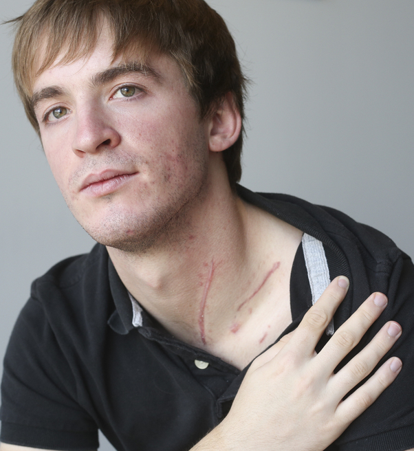 A real-life Superman: Stephen Barton, Aurora survivor, makes the most out of&nbsp;tragedy